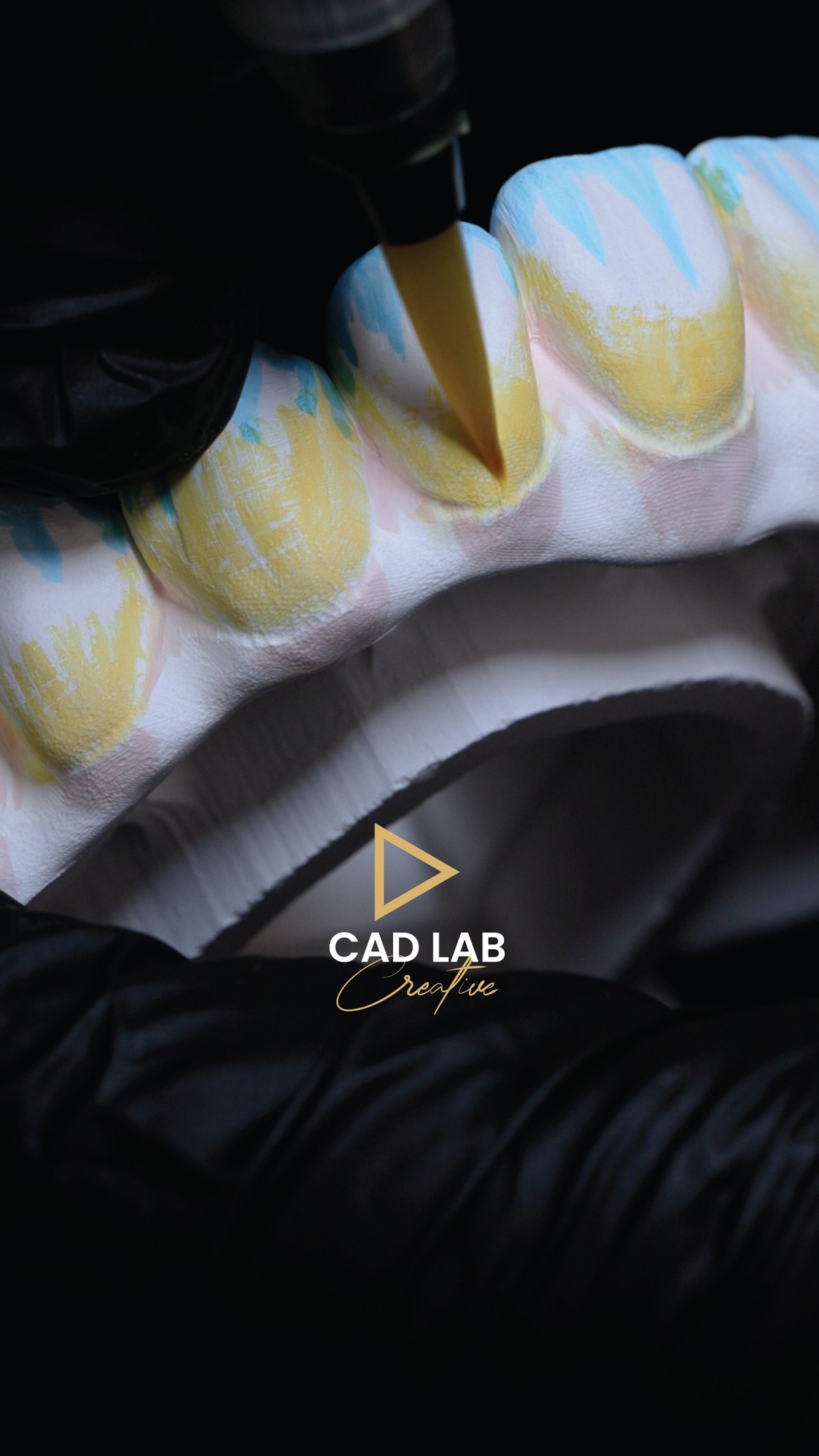 Precision laboratory work on a dental case in our in-house lab