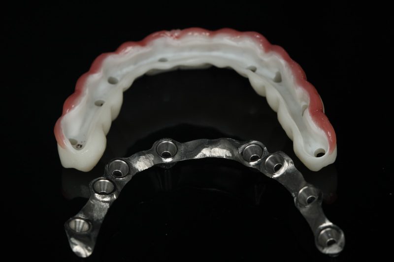 A full-arch implant framework beside the finished prosthesis it supports, made at Creative Art Dental Lab