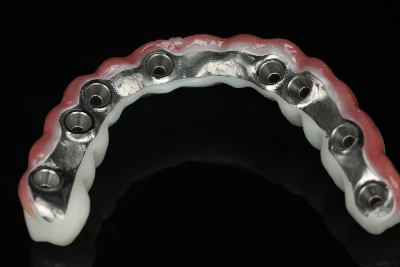Wisdom teeth: what people ask before having them out