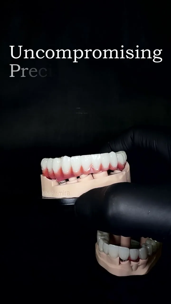 هيكل زرعات للفك كامل
