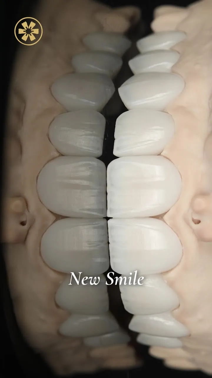 Un nuovo sorriso, pronto