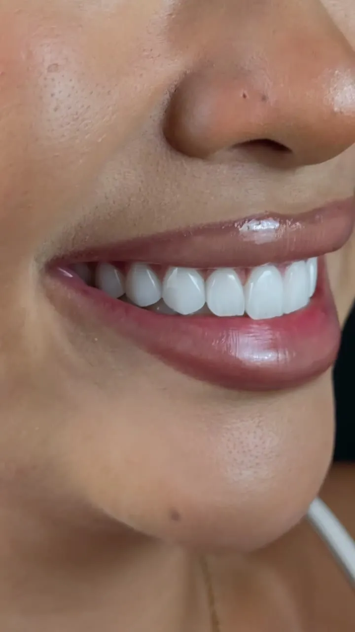 Nuovo sorriso