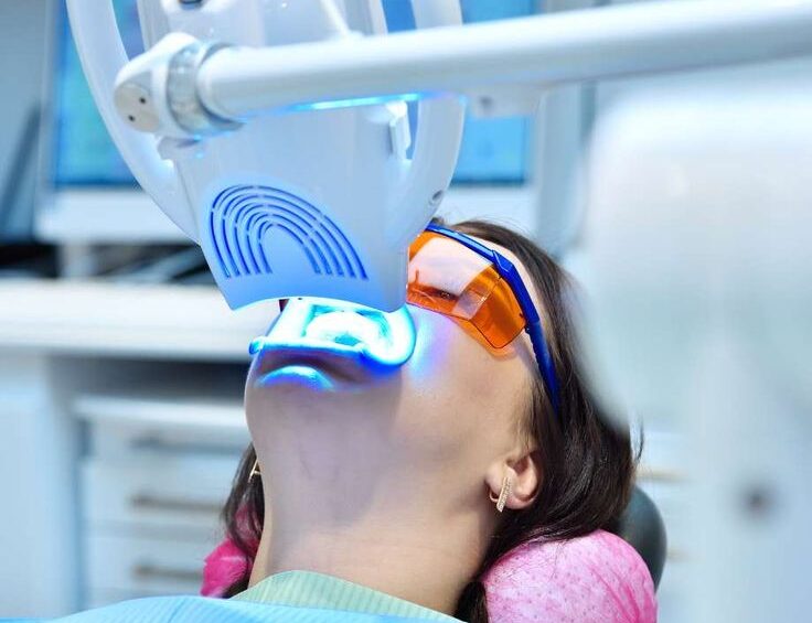 Professional Teeth Whitening: Zoom vs. Laser in Dubai Clinics