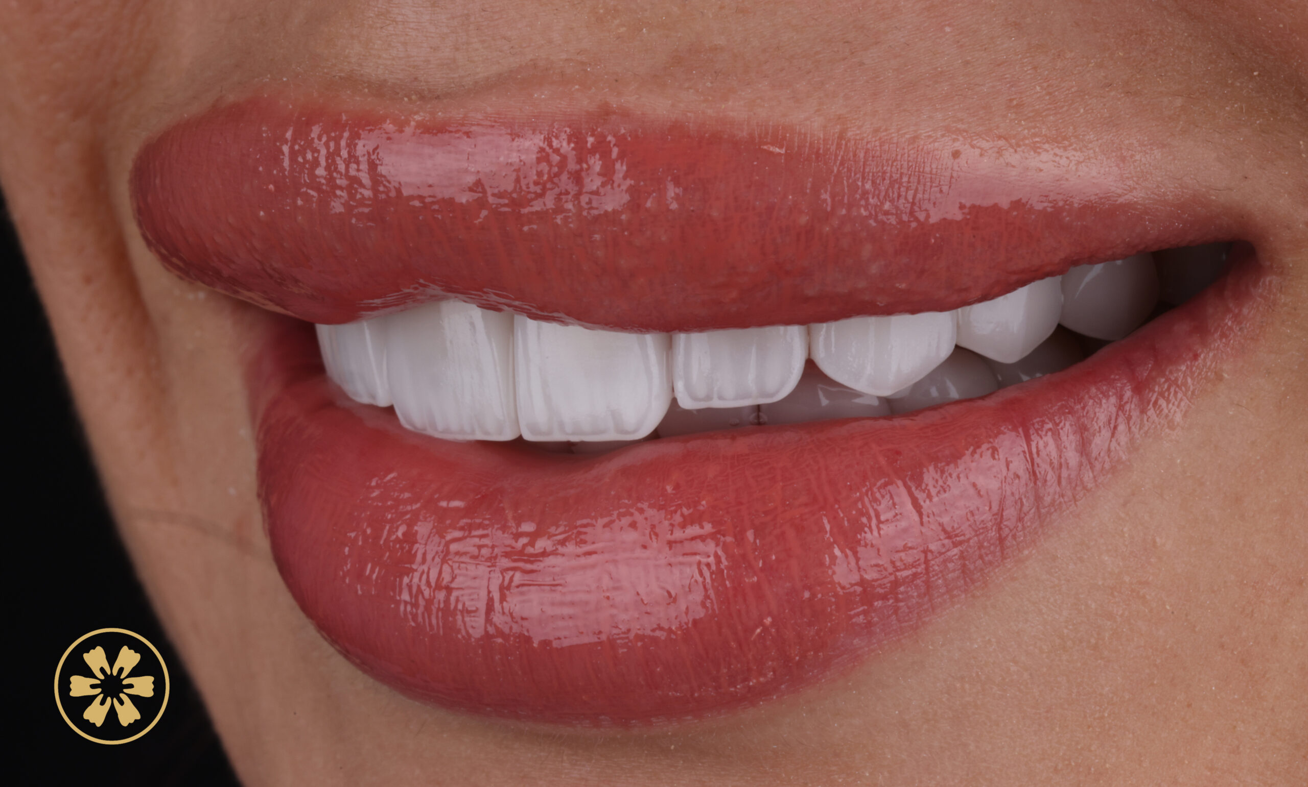 Cosmetic Dentistry